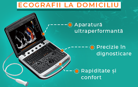 Ecografii Medcenter la domiciliu